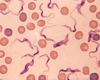 Trypanosoma sp. 